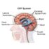 Cerebrospinal fluid opening pressure in relation to symptomatology and craniocervical anatomy in patients with myalgic encephalomyelitis/chronic fatigue syndrome