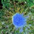 Identification of SGK1 as a candidate regulator associated with myeloid cell senescence in ME/CFS: An integrative transcriptomic and experimental study